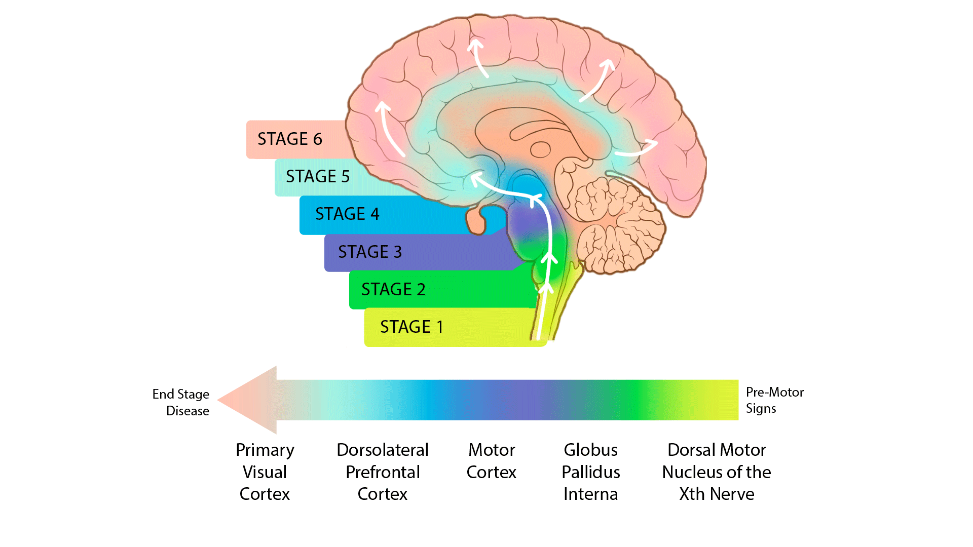 Brain Stage Graphic